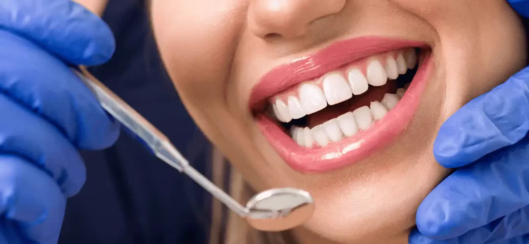 השתלת שיניים: המדריך המלא לתהליך בטוח ומצליח