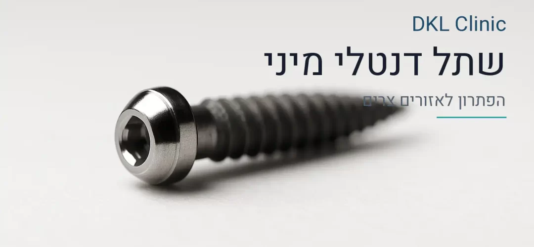 שתל דנטלי מיני — DKL Clinic נס ציונה