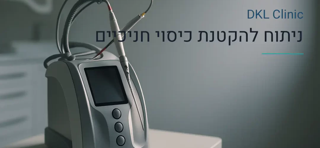 ניתוח להקטנת כיסוי חניכיים — DKL Clinic נס ציונה