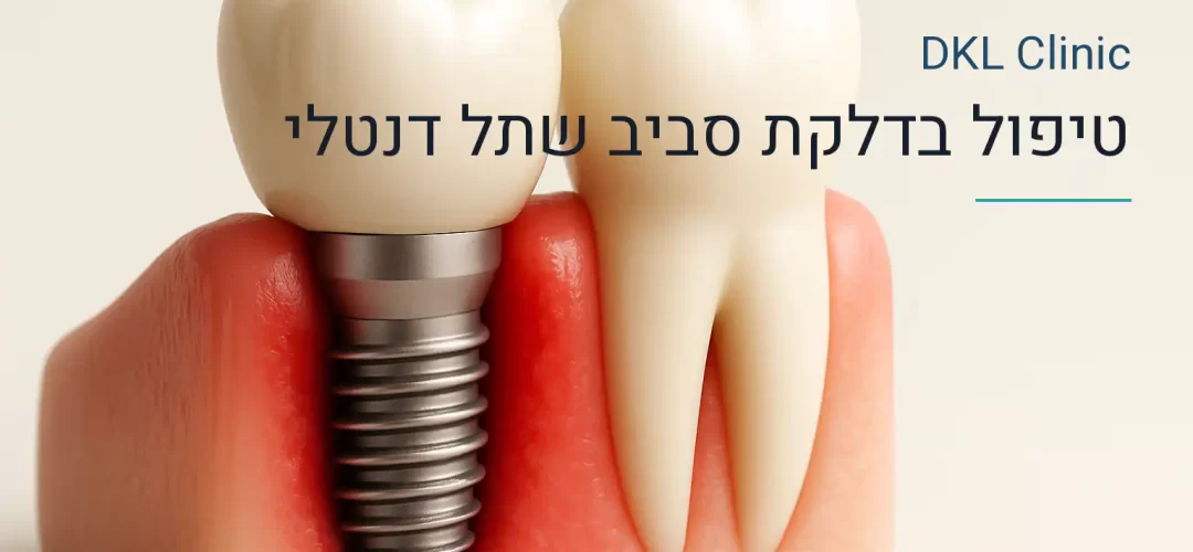 טיפול בדלקת סביב שתל דנטלי — DKL Clinic נס ציונה