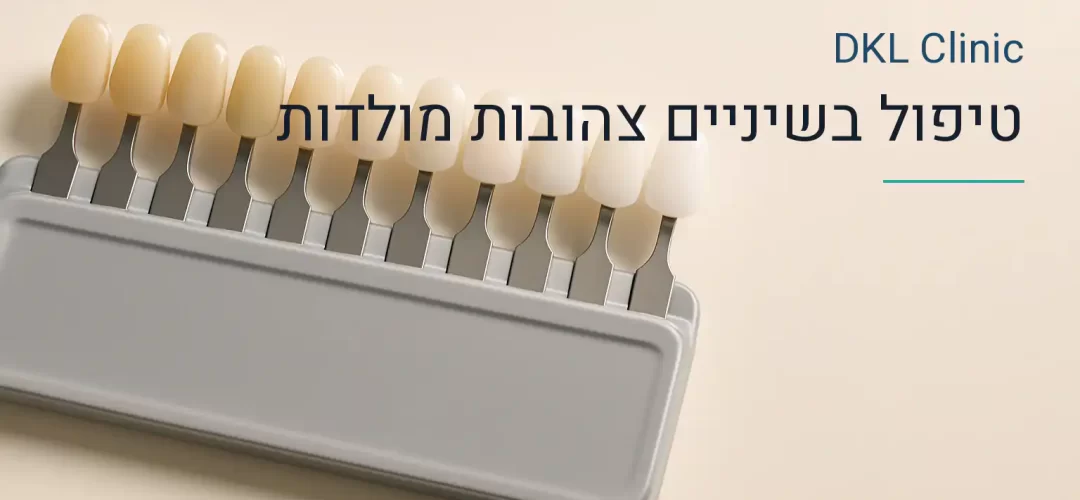 טיפול בשיניים צהובות מולדות — DKL Clinic נס ציונה