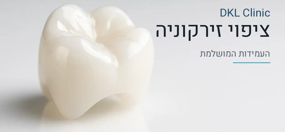 ציפוי זירקוניה — DKL Clinic נס ציונה